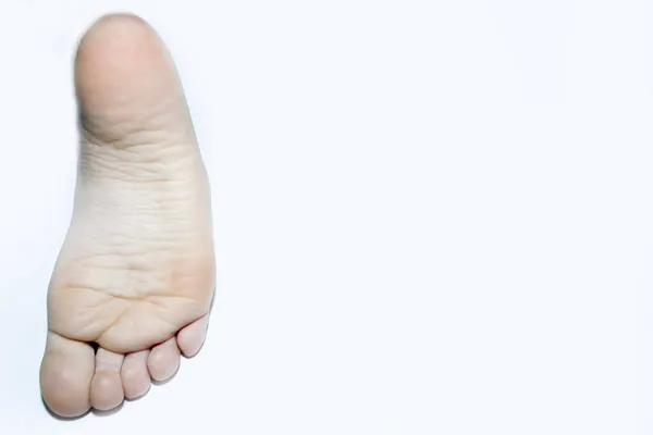 The foot of a teenager of 9 years on a white background. — Stock Photo, Image