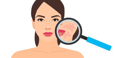 Dermatoloji büyüteç kadın cilt sorunlu cilt vektör illüstrasyonu