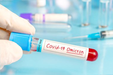 Doctor with positive blood sample for the new variant detected of the coronavirus strain called covid Omicron. Research of new african strains and mutations of Covid 19 coronavirus in the laboratory clipart