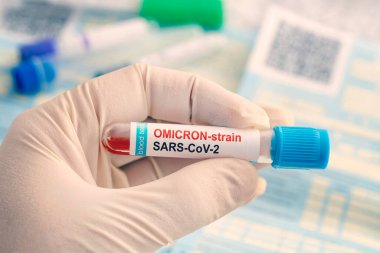 Doctor with a positive blood sample for new variant detected of the coronavirus strain called covid Omicron. Research of new african strains and mutations of the Covid 19 coronavirus in the laboratory clipart
