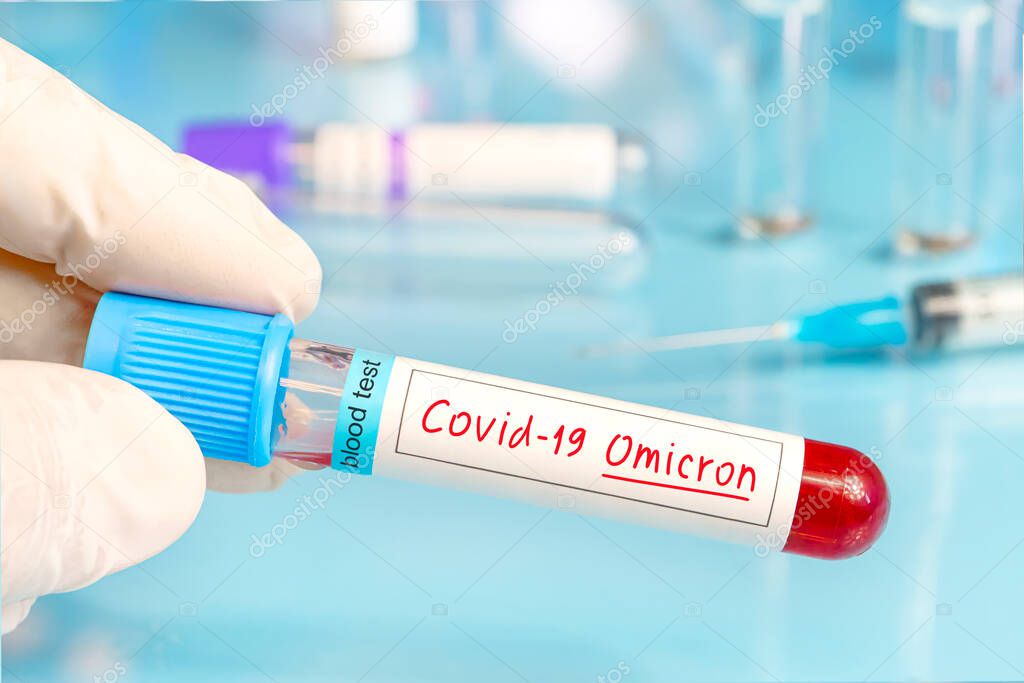 Doctor with positive blood sample for the new variant detected of the coronavirus strain called covid Omicron. Research of new african strains and mutations of Covid 19 coronavirus in the laboratory