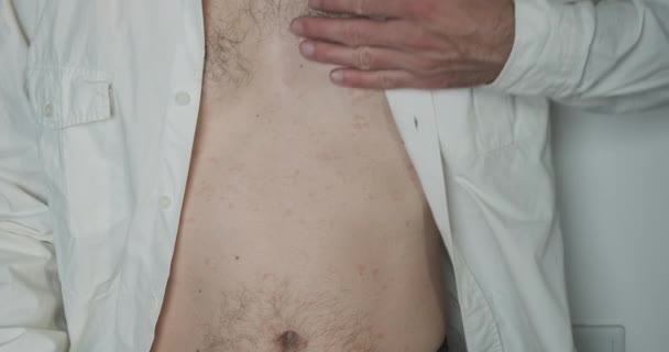 Patient Skin Disease White Shirt Scratches Red Dots Skin Pityriasis — Stock Video