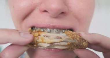 Diş teli takmış, kızarmış tavuk kanadı ısıran tanınmamış bir kadın. Yakın çekim, ön manzara. Jaws açgözlülükle et çiğner. Fast food ile açlığı gidermek. Yüksek kalite 4k görüntü