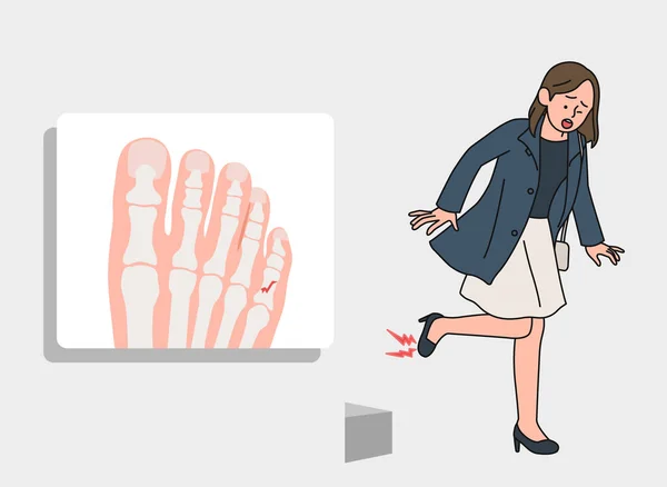 Toe Fracture Accident Wearing High Heels —  Vetores de Stock