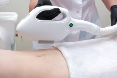 Genç bir kız için lazer tüyü çıkarma. Uzman, vücuttan lazer tüy çıkarma prosedürünü uygular.