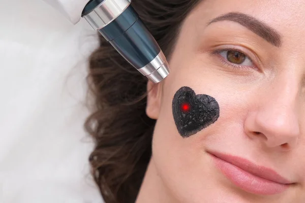 Das Mädchen Wird Einem Kohlenstoff Peeling Unterzogen Ein Laserstrahl Wird — Stockfoto