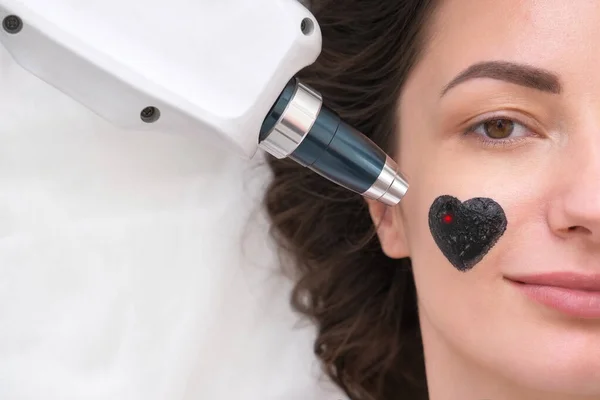 Das Mädchen Wird Einem Kohlenstoff Peeling Unterzogen Ein Laserstrahl Wird — Stockfoto