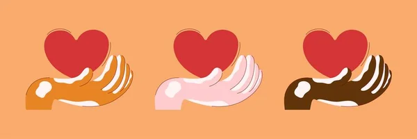 Vitiligo deri hastalığı olan bir adamın elleri. Farklı ten renkleriyle ayarlanmış. Destek, sevgi ve yardım. Dünya Vitiligo Günü. Düz vektör çizimi izole edildi