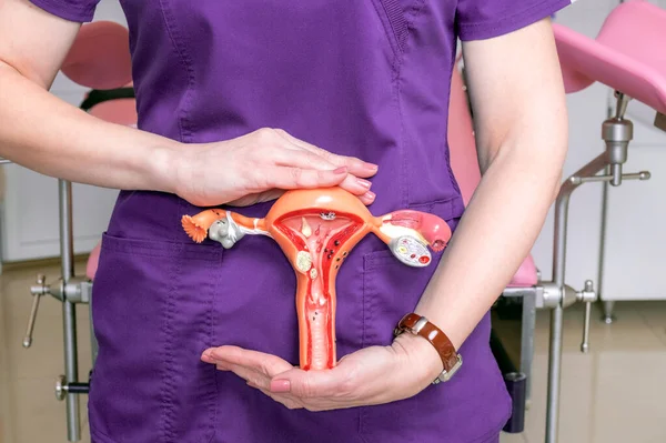 Kadın jinekolog, kadın üreme sisteminin bir planını tutuyor..