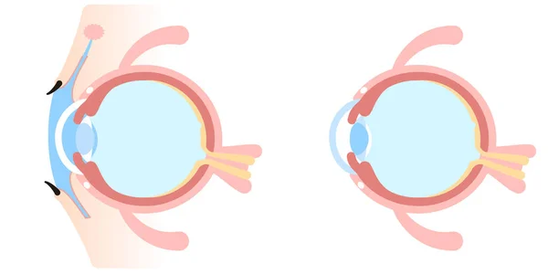 Cross Section Eyeball — Vettoriale Stock