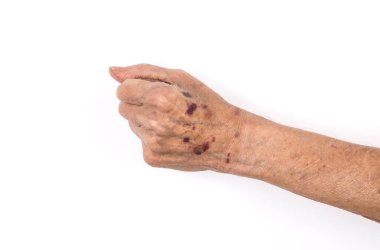 Yaşlı adamın elleri beyaz arka planda.