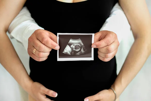 Беременность Беременная Женщина Мужем Проведение Небольшой Съемки Ожидание Ребенка Беременность — стоковое фото