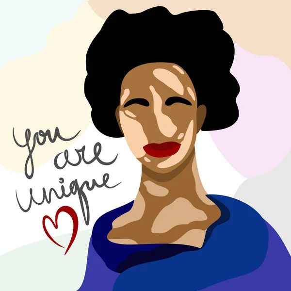 Vitiligo 'su olan bir kadının vektör çizimi. Sen eşsizsin. Dünya Vitiligo Günü.