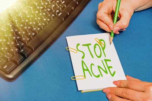 Señal de escritura a mano Stop Acne. Concepto que significa controlar la aparición de glándulas sebáceas inflamadas en la piel Manos apuntando presionando teclas de teclado de computadora escribiendo nuevas ideas. —  Fotos de Stock