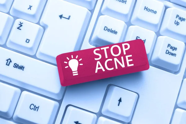 Inspiration showing sign Stop Acne. Business idea control the occurrence of inflamed sebaceous glands in the skin Browsing Online Transaction History, Creating Organized File System — Stock Photo, Image