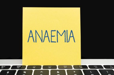 Kavramsal manşet anemi. İş konsepti, kan bürosundaki hemoglobin eksikliğine işaret ediyor. Masanın üzerinde klavye, bardak ve çalışmak için kahve fincanı var.