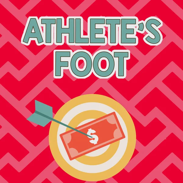 Skriv under som visar idrottaren S is Foot. Affärsöversikt en svampinfektion i foten som kännetecknas av blåsor Valuta Pinned Through Target By Arrow Beskriv Finansiell planering. — Stockfoto