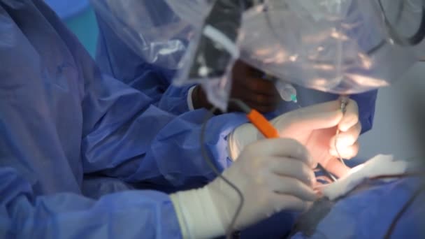 Kyiv Ucraina Maggio 2022 Neurochirurgo Esegue Shunt Ventricolo Peritoneale Conduttore — Video Stock