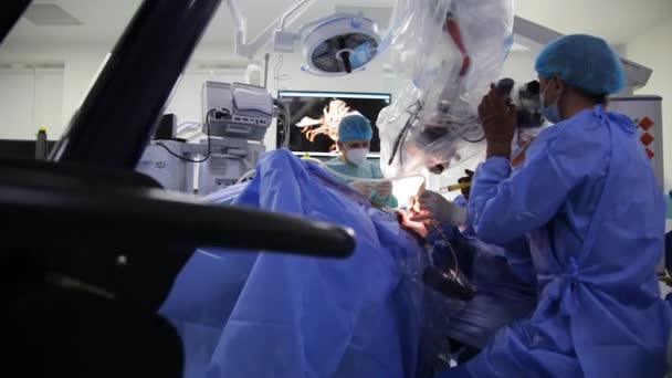 Kyiv Ucrânia Maio 2022 Tratamento Aneurisma Cerebral Operação Cirúrgica Cérebro — Vídeo de Stock