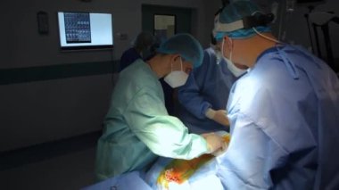 KYIV, UKRAINE - 25 Mayıs 2022: Nörocerrah ventrikül-peritoneal shunting yapar. Şant tıbbi kondüktörü. Ventrikül-periton ameliyatı. Şant rehberi ile yan yana. Editör görüntüsü.