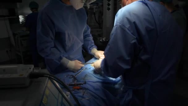 Kyiv Ukraine May 2022 神经外科医生进行腹侧腹腔分流 分流医疗导体 腹膜分流症外科 带有分流导引 编辑视频 — 图库视频影像