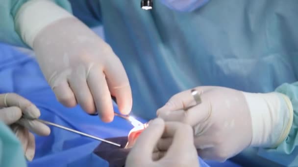 Vinnytsia Ucraina Giugno 2022 Rinochirurgia Funzionale Ripristino Della Respirazione Nasale — Video Stock