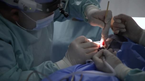 Функціональна Хірургія Носа Відновлення Носового Дихання Вирівнювання Перегородки Носоглотки Хірурги — стокове відео