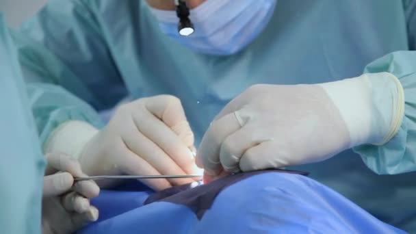 Rinocerurgia Funcional Para Restauración Respiración Nasal Alineación Del Tabique Rinoplastia — Vídeo de stock