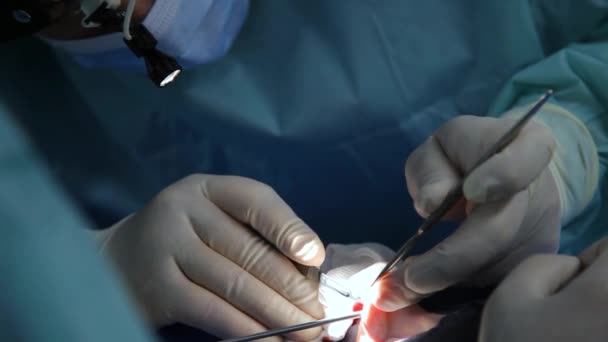 Функціональна Хірургія Носа Відновлення Носового Дихання Вирівнювання Перегородки Носоглотки Хірурги — стокове відео