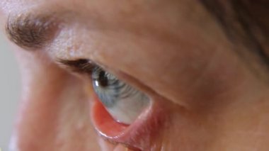 Bir kadın kontak lens takıyor. Kontak lensler. Kontakt lenslerle görme düzeltmesi.