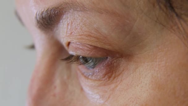 Kvinna Sätter Sig Kontaktlinser Kontaktlinser Synkorrigering Med Kontaktlinser — Stockvideo