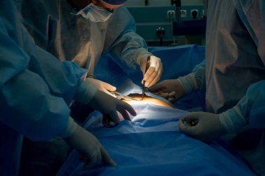 Cerrah ve asistanlar insan vücudunu ameliyat ederler. Doktor dikişleri