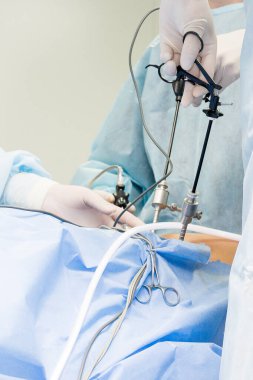 Cerrah karın bölgesinden laparoskopik ameliyat yapar. Laparoskop ve doktor eli yakın plan.