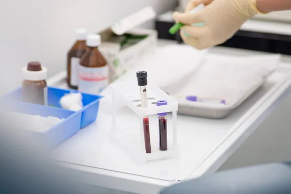 Handskar Laboratorieassistent Förbereder För Blodprovstagning Mot Bakgrund Blodrör — Stockfoto