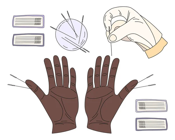 Acupuncture Therapist Hands Guide Patient Alternative Medicine Procedure Sterile Packaged — Stock Vector