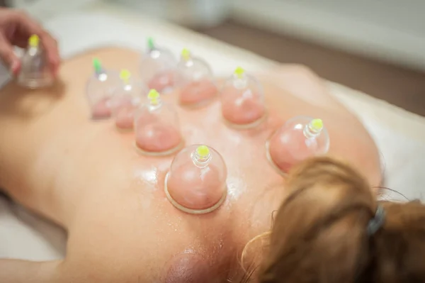 Glass vacuum cupping therapy on a woman's back, acupuncture treatment. Ventosa traditional massage. Alternative Medicine. Medical health care