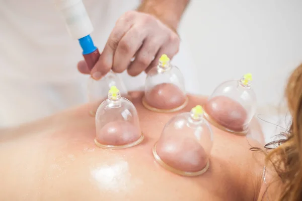 Glass Multiple Vacuum Cup Medical Cupping Therapy Women Back Ventosa — Foto Stock