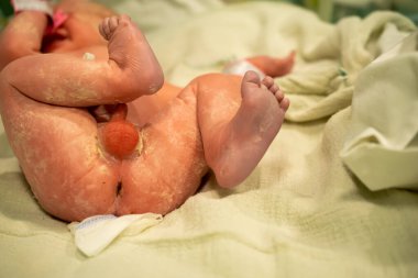 Doğumdan hemen sonra hastanede yeni doğmuş bir bebek.