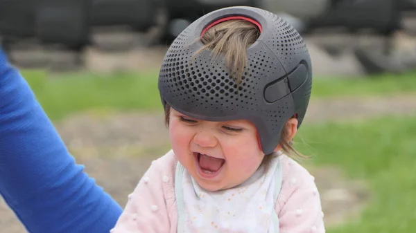 Bambina Che Indossa Casco Rimodellamento Cranico Testa Piatta — Foto Stock