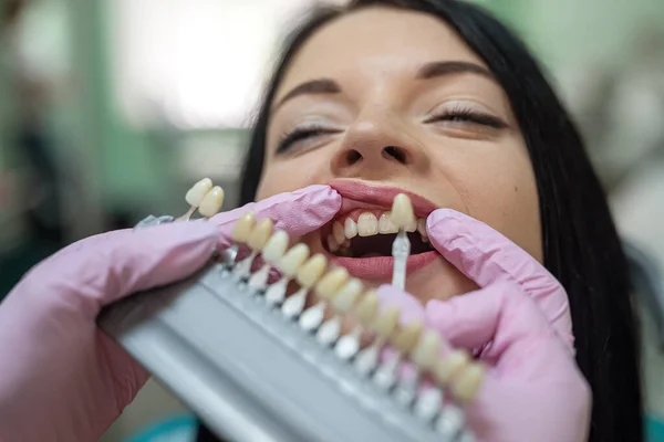 Diş Hekimi Hastanın Dişini Diş Hekimliğindeki Renk Örneğiyle Karşılaştırıyor — Stok fotoğraf
