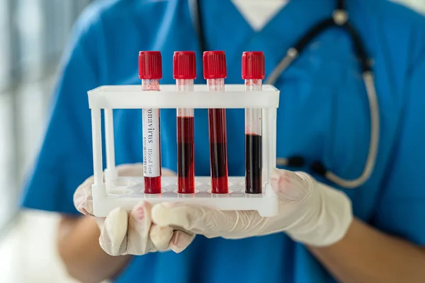 Young Beautiful Nurse Stands Hallway Uniform Holds Blood Samples Medicine — Stockfoto