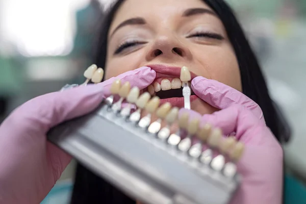 Diş Hekimliğindeki Hasta Numuneden Diş Rengini Seçmiş — Stok fotoğraf