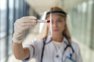 Beyaz eldivenli genç doktor koridorda üzerinde kan testleri olan test tüpleri tutuyor. Tıp konsepti
