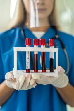 Üniformalı genç bir hemşire laboratuara kan örnekleri taşıyan test tüpleri taşıyor. Tıp konsepti
