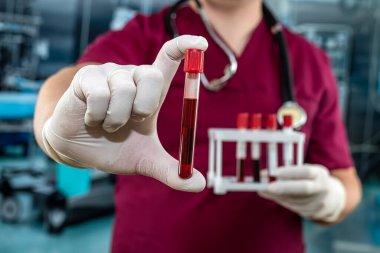 Kırmızı üniformalı doktor laboratuvar hastanesinde Coronavirus için test tüpünde kan tutuyor..