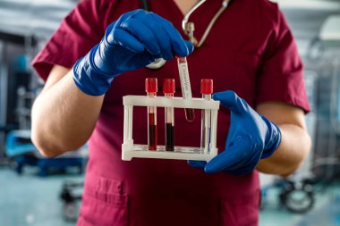 Erkek doktor ya da biyokimyacı kırmızı üniforma giyer, virüs hastalığından alınan eldivenler modern hastanedeki bir test tüpünde kanı inceler.