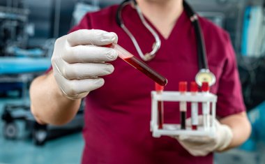Erkek doktor ya da biyokimyacı kırmızı üniforma giyer, virüs hastalığından alınan eldivenler modern hastanedeki bir test tüpünde kanı inceler.