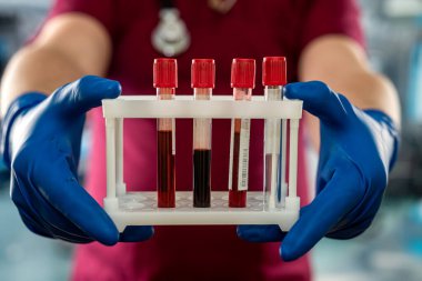 Kırmızı üniformalı doktor laboratuvar hastanesinde Coronavirus için test tüpünde kan tutuyor..