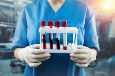 Young female nurse scientist looking on test tube with blood in operating at hospital. medical concept