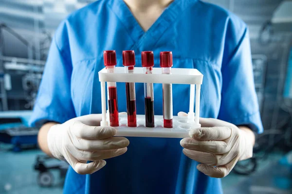 Hemşire analiz için test tüplerinde kan tutuyor. Klinik laboratuarında çalışıyorum.